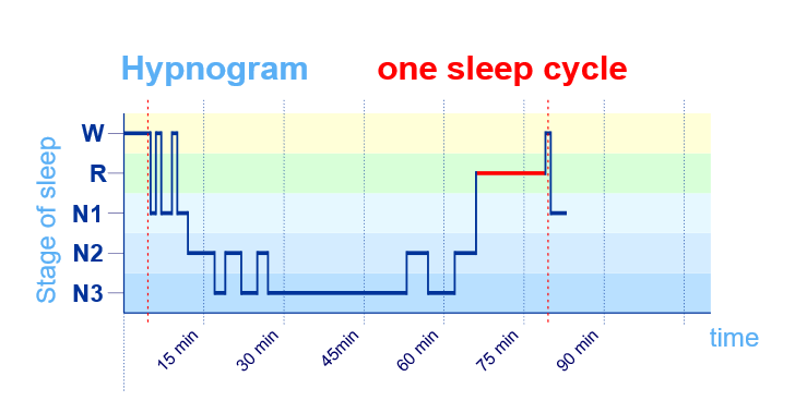 图 1 睡眠样本